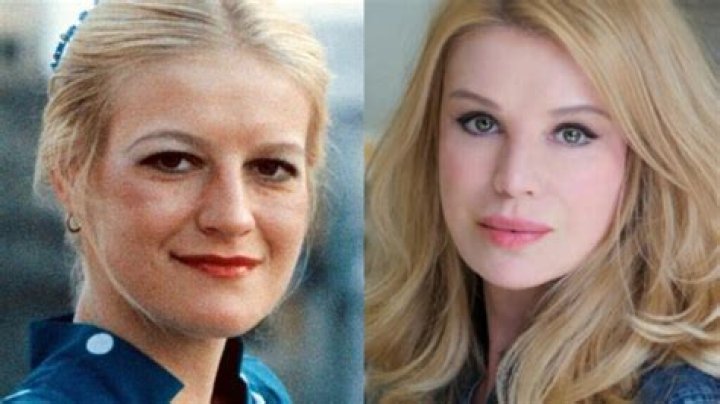 Unveiling Cindy Jackson's Plastic Surgery Journey: Discoveries And Insights